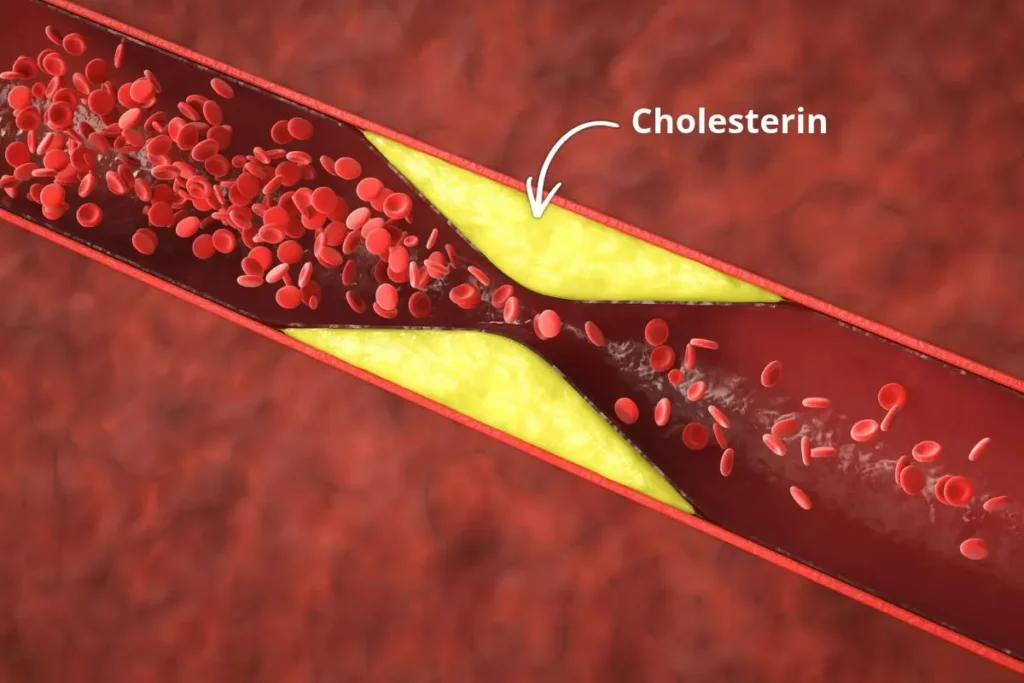 Cholesterin senken mit gesunder Ernährung