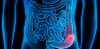 Welche Tests eignen sich zur Früherkennung? Früherkennung