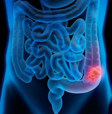 Welche Tests eignen sich zur Früherkennung? Früherkennung