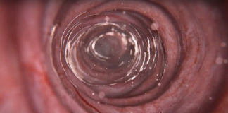 Erschreckende Erkenntnisse: E171 aus Zahnpasta gefährlich für Darm E171