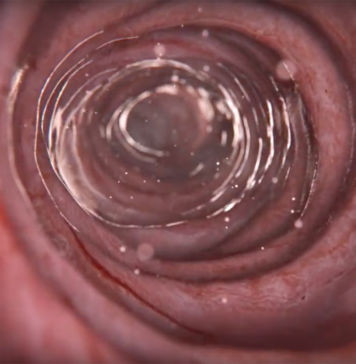Erschreckende Erkenntnisse: E171 aus Zahnpasta gefährlich für Darm E171