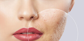 Die Haut als Spiegelbild Deiner Gesundheit / Online Abend mit Marcus Stanton – 08.12.2021 Podcast Pickel