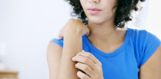 Was hilft bei Nesselsucht? Nesselsucht