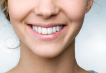 Studie: So verringern Sie das Risiko von Zahnverlust Zahnverlust