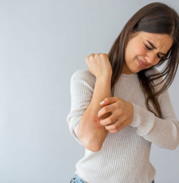 Juckende Ekzeme – Was können Sie tun?