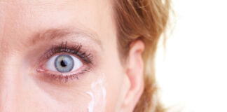 Falten – Gibt es ein Heilmittel?