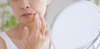 Altersflecken – Werde ich die wieder los?