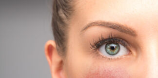 Rosazea – Warum Sonnenschutz gerade für Betroffene wichtig ist