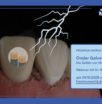 Oraler Galvanismus – Webinar mit Dr. Wolfgang Kufahl